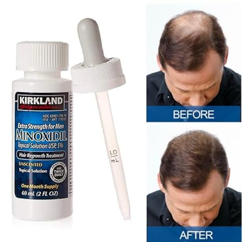 6 bouteilles  de croissance capillaire Kirkland avec 5 % de minoxidil, favorise la croissance des cheveux, pour hommes, 6 mois d'approvisionnement