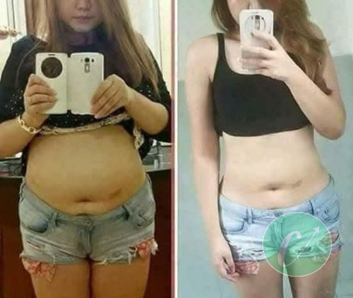 Burn Slim complément alimentaire amincissant 